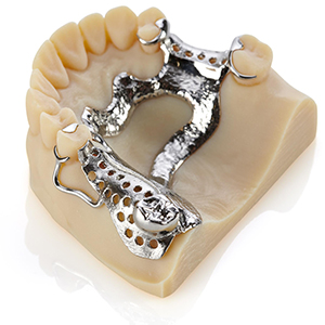 3D nyomtatás - forradalom a fogászati iparban
